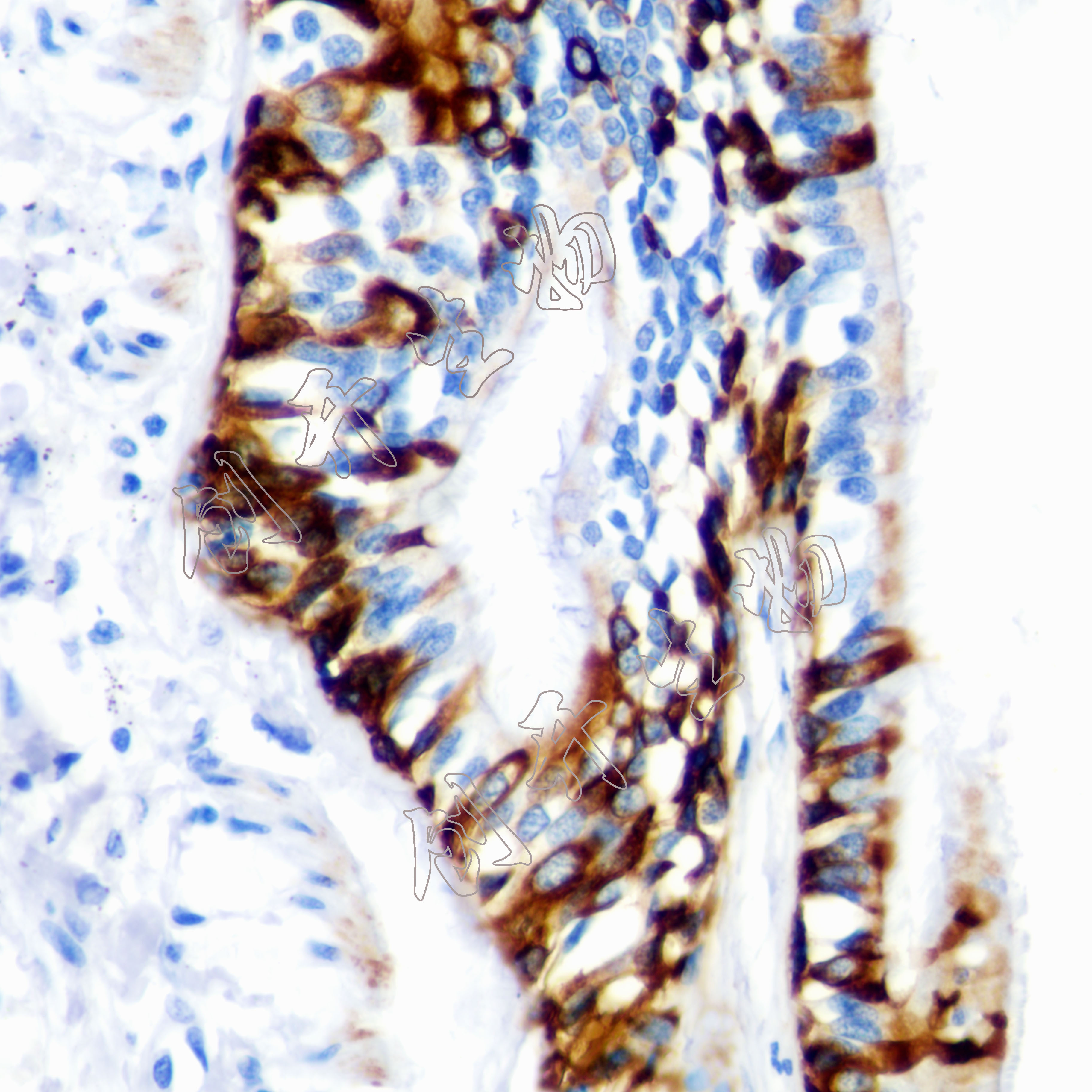 Cytokeratin 5 (CK-5)