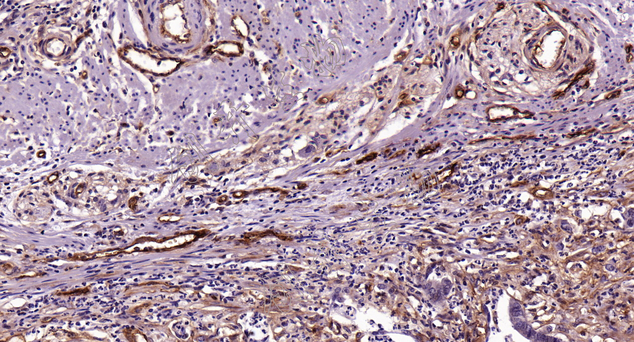 CD105(Endoglin)